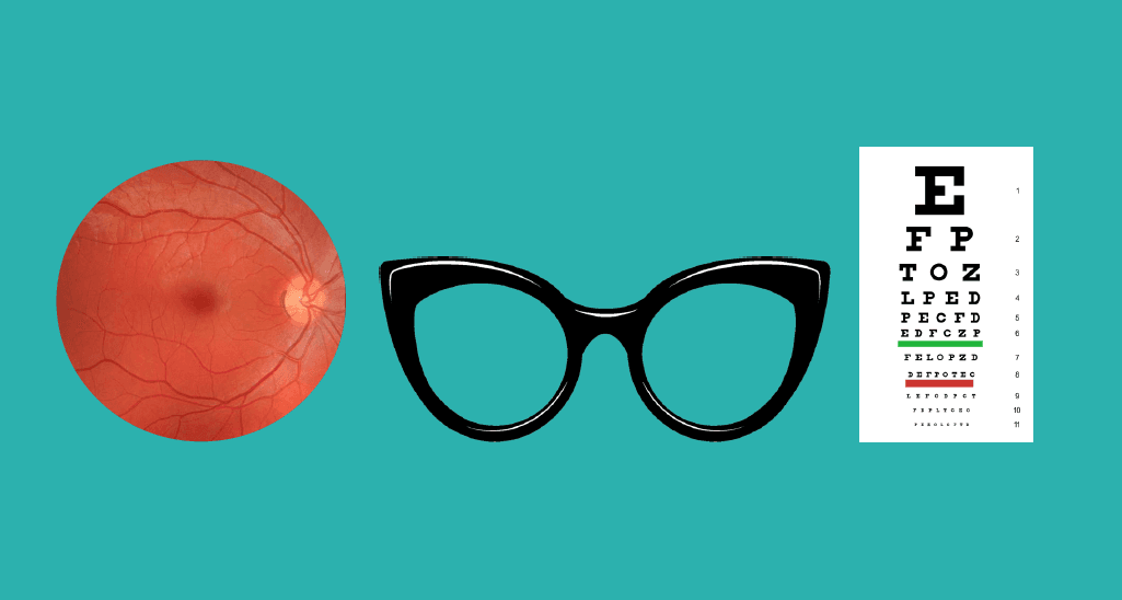 @180 Optometry & Eyewear- Kitsilano Optometrist- Vancouver Eye Doctor- Myopia Control & Diabetic Eye Clinic photo 2