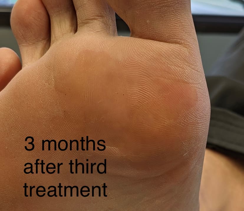 Burlington Health Focus Foot Clinic, podiatry & foot care in Burlington, photo 2