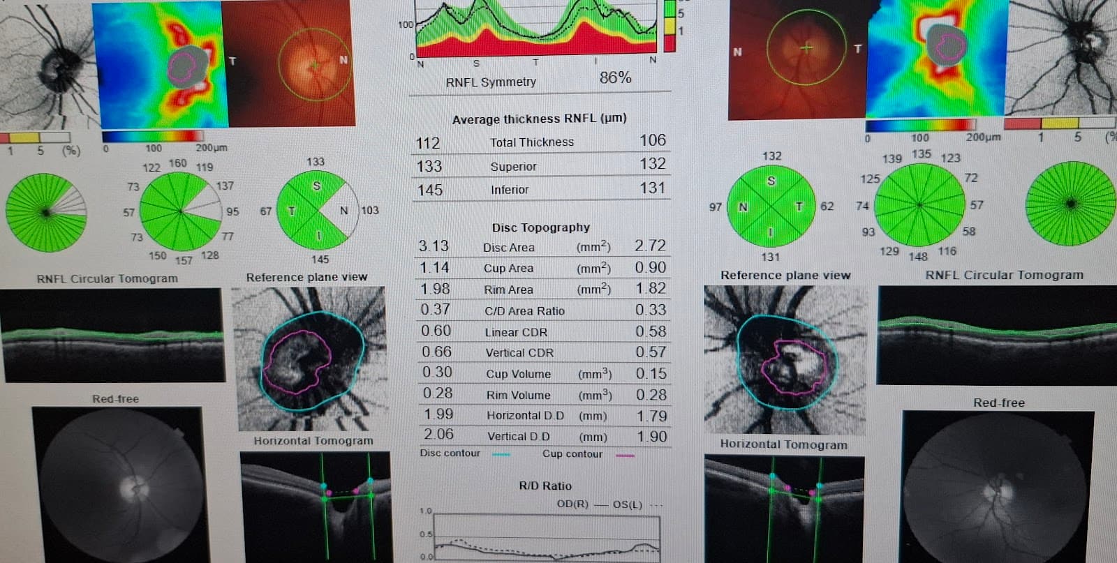 Clinique VisionPros