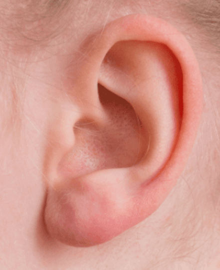 Davidson Hearing Aid Centres photo 5