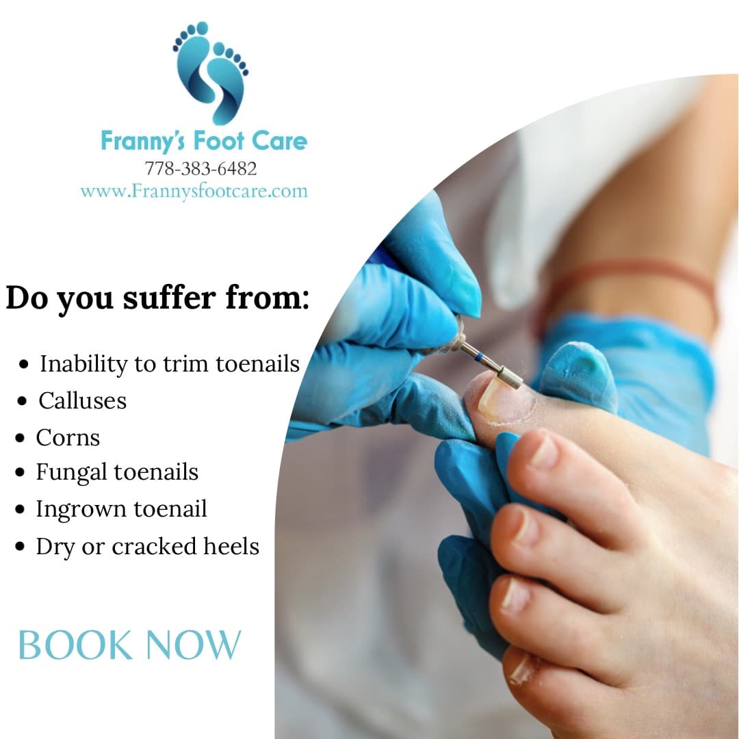 Franny’s Foot Care photo 4