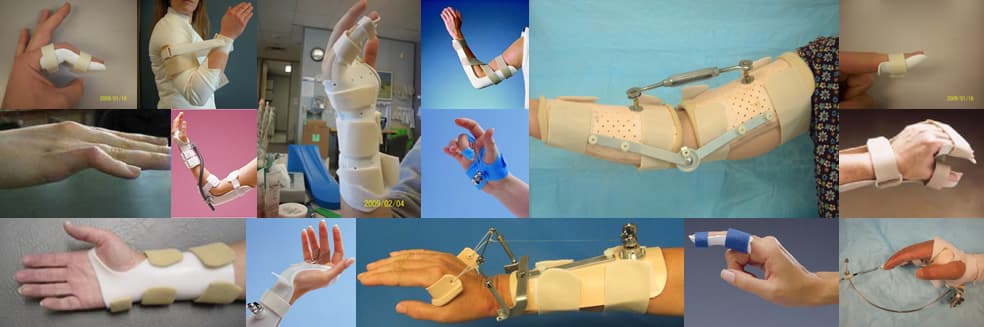 Hand Therapy Canada photo 3