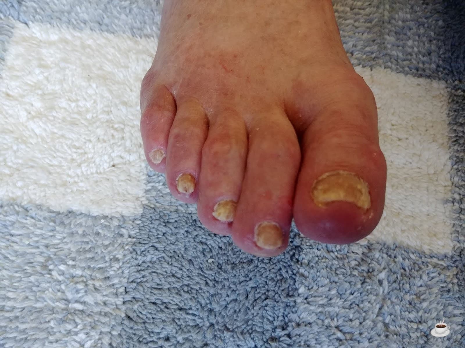 Healthy Feet Mobile FootCare Services photo 1 of 4