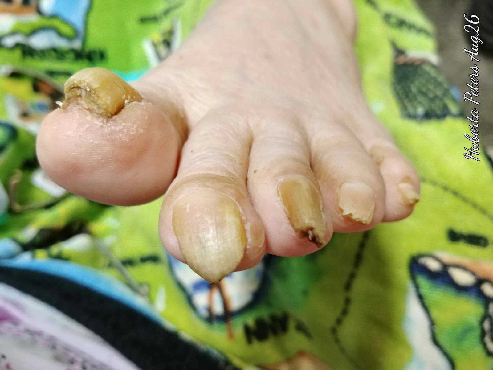 Healthy Feet Mobile FootCare Services photo 2