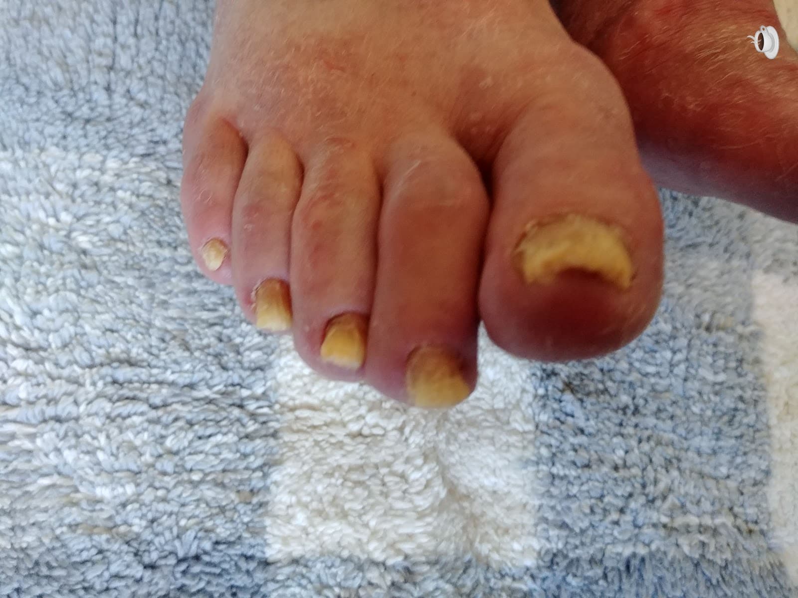 Healthy Feet Mobile FootCare Services photo 3
