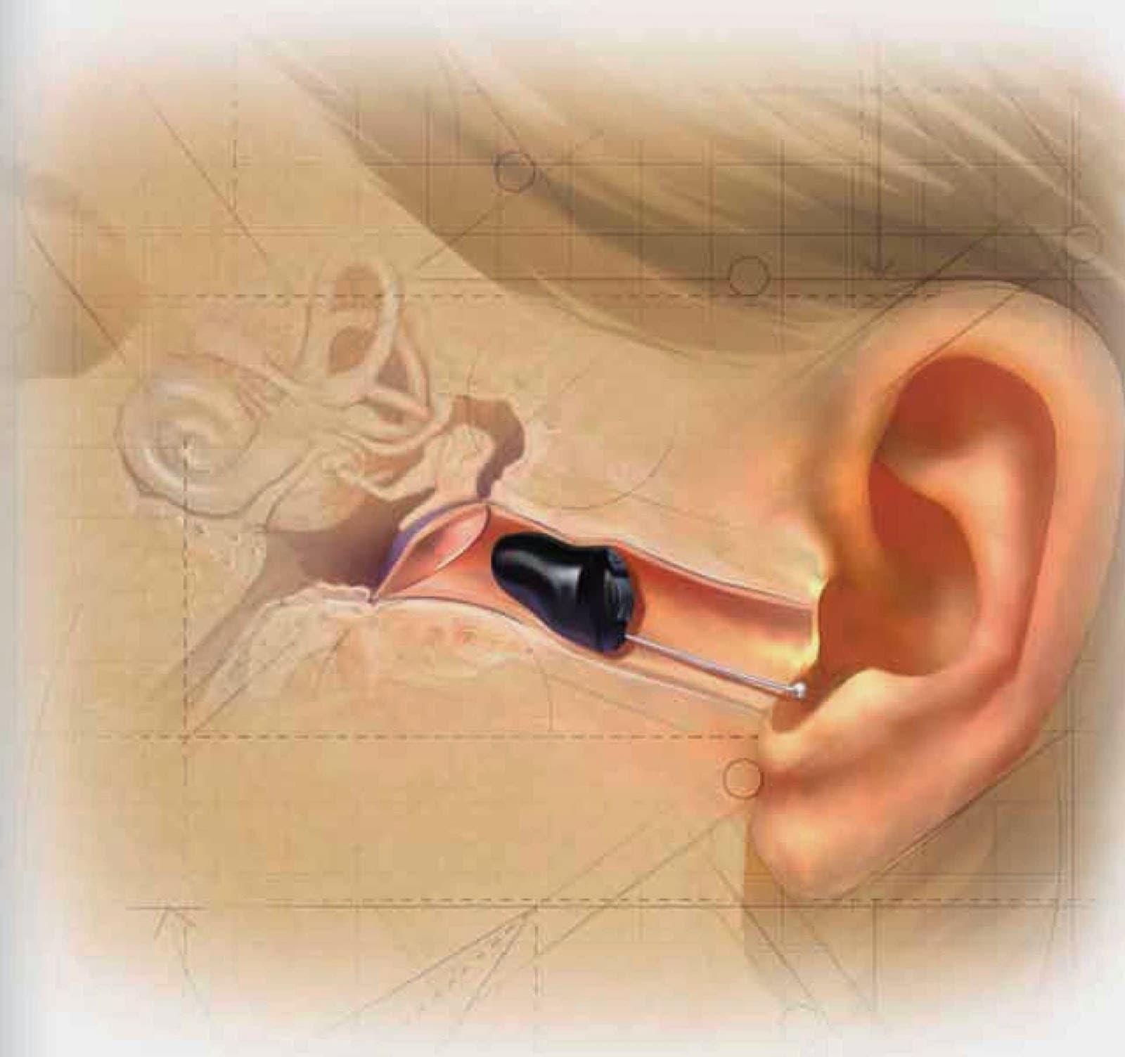 HearingLife photo 5