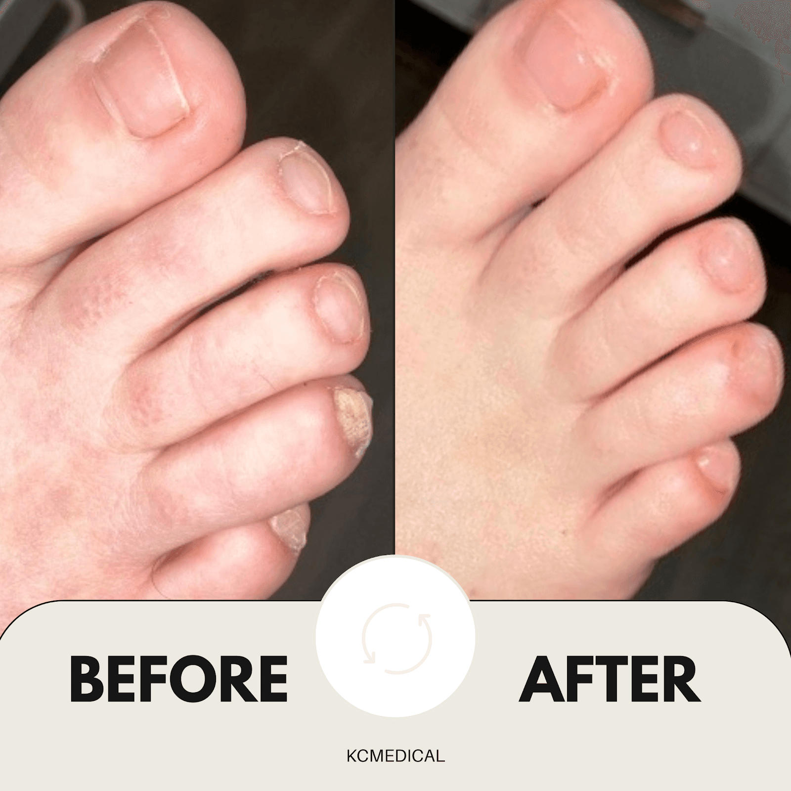 KC Medical Foot Care Nurse, podiatry & foot care in Langley, photo 3
