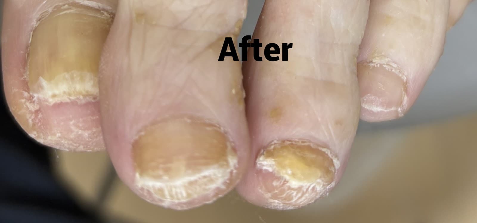 North London Foot Care photo 2