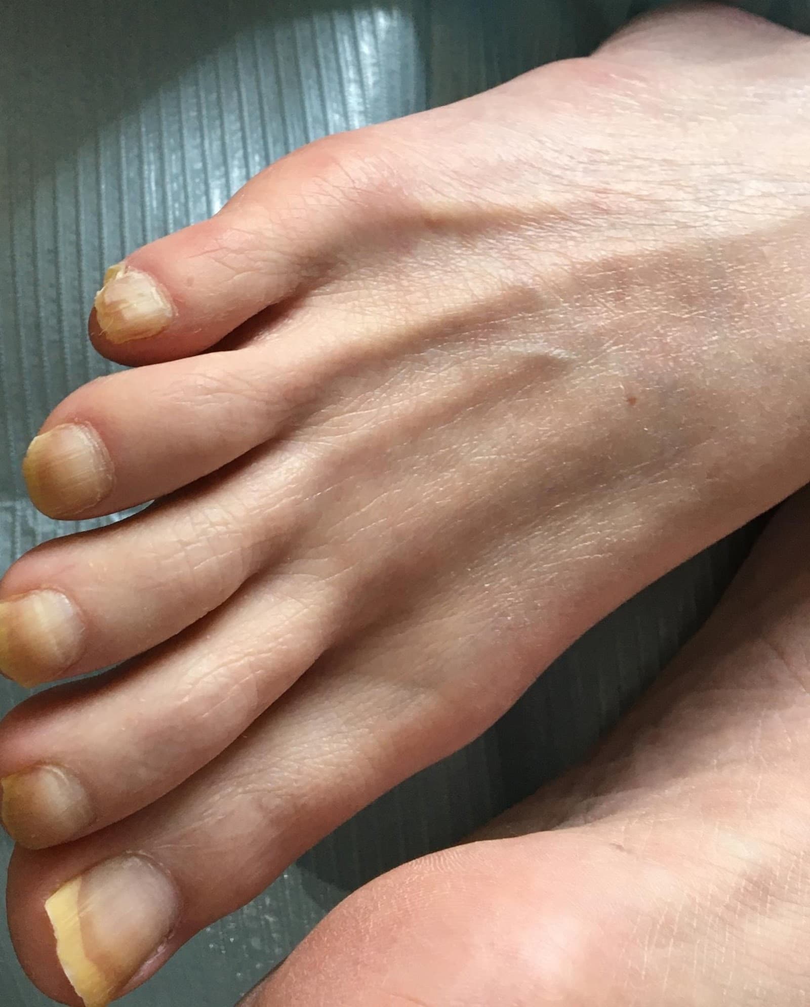 North London Foot Care photo 3