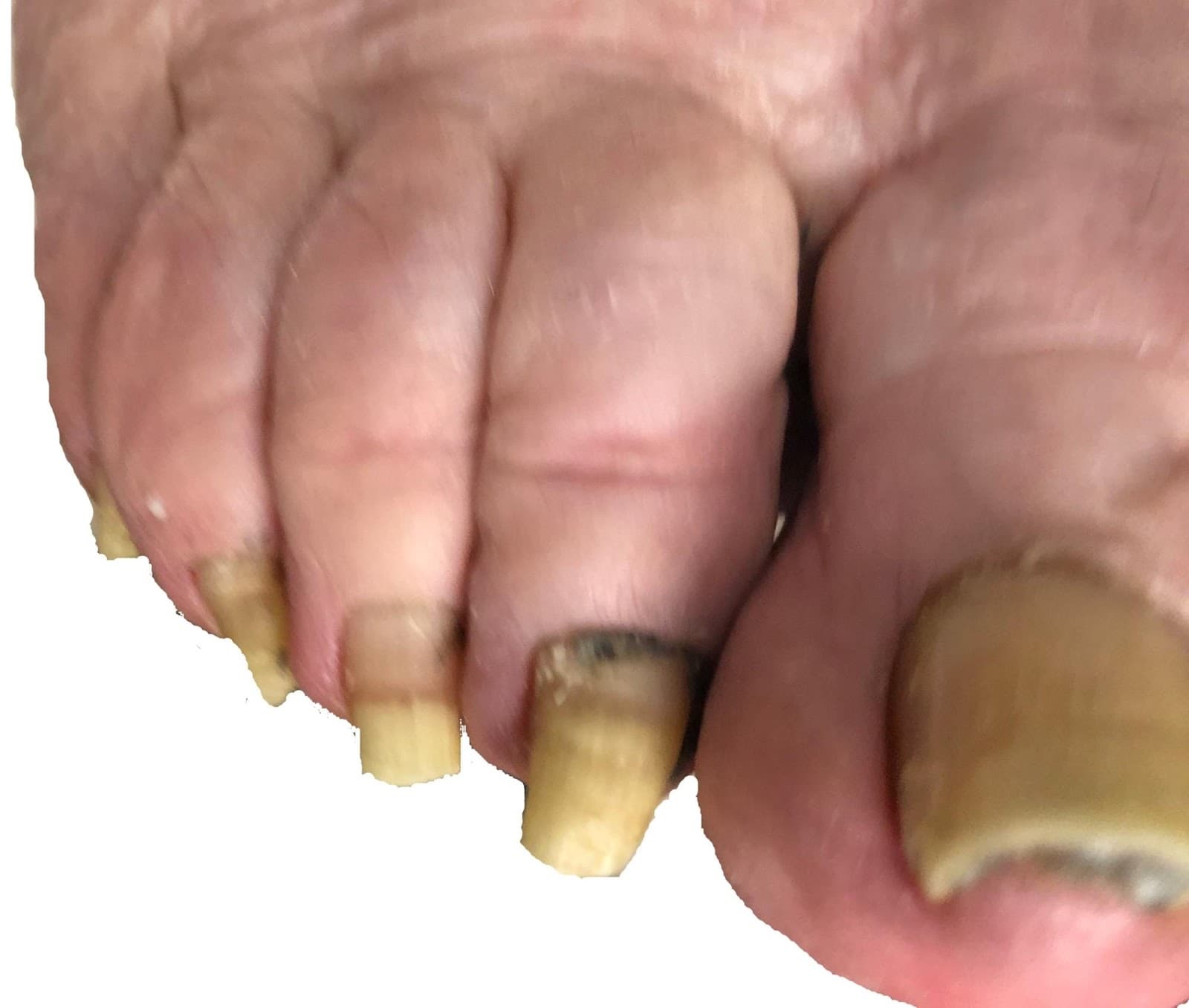 North London Foot Care photo 4