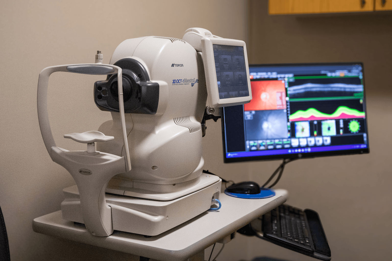 Optometry Clinic of Stoney Creek photo 4