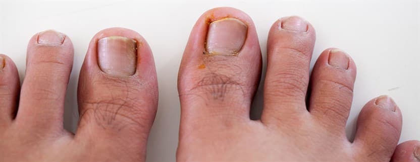 Step Ahead Podiatry Clinic DT Edmonton photo 3