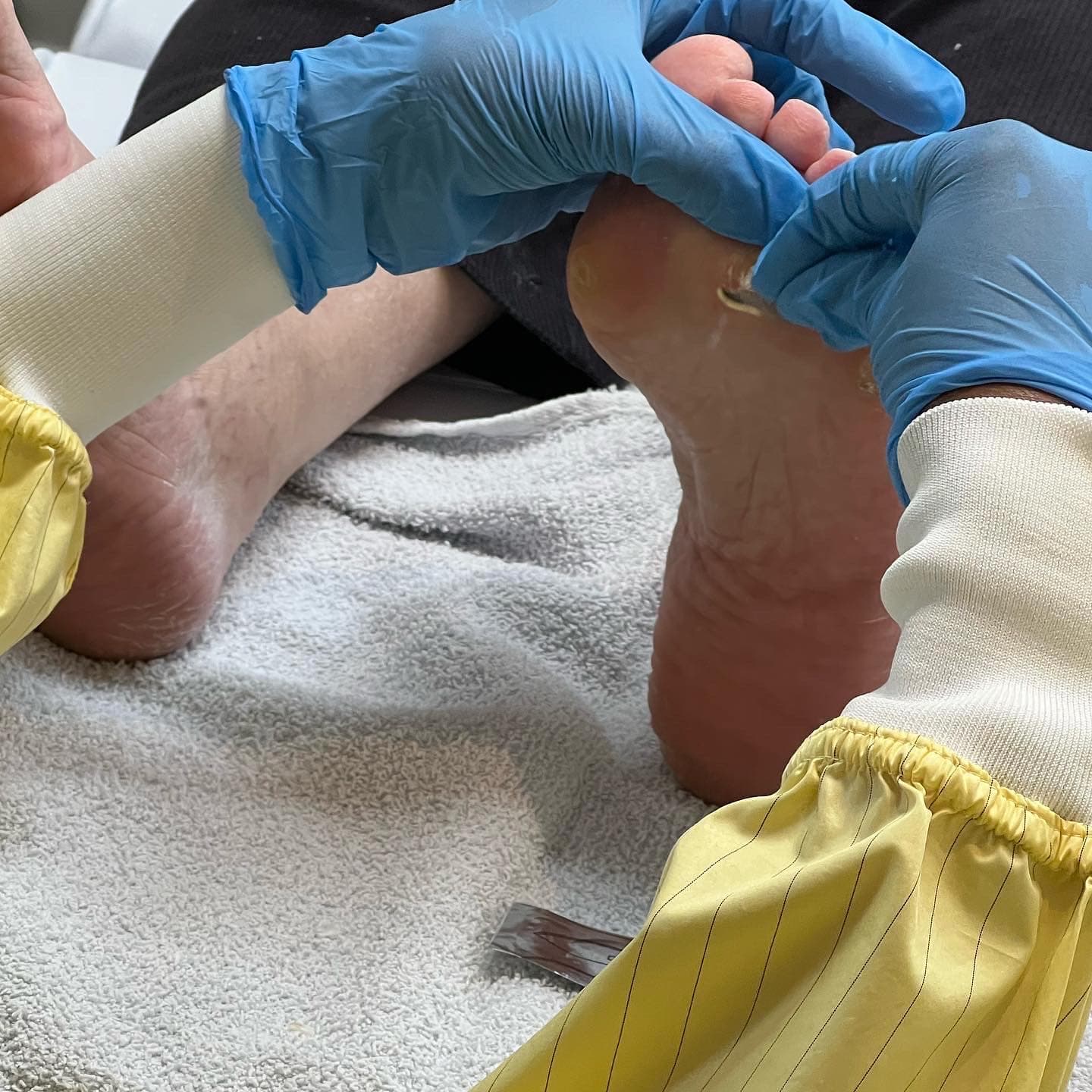 Tiredsole Complete Medical Foot Care - Foot Care in Ottawa in Ottawa