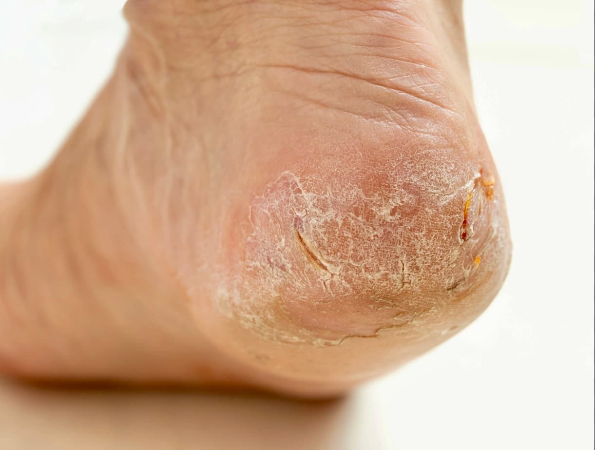 ToeTalk Certified Footcare Clinic photo 3