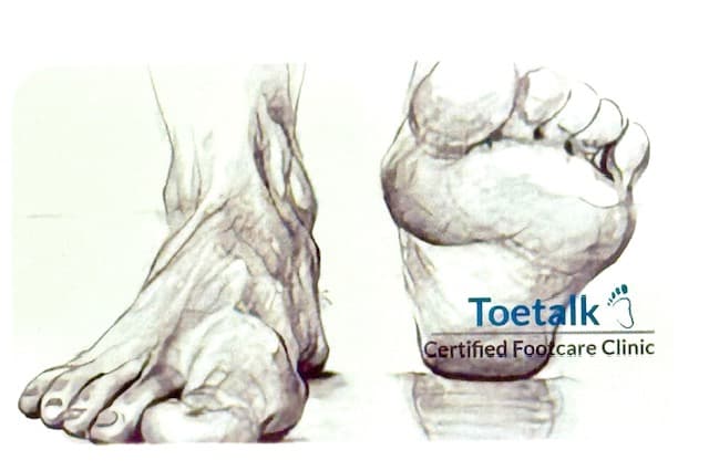ToeTalk Certified Footcare Clinic photo 4