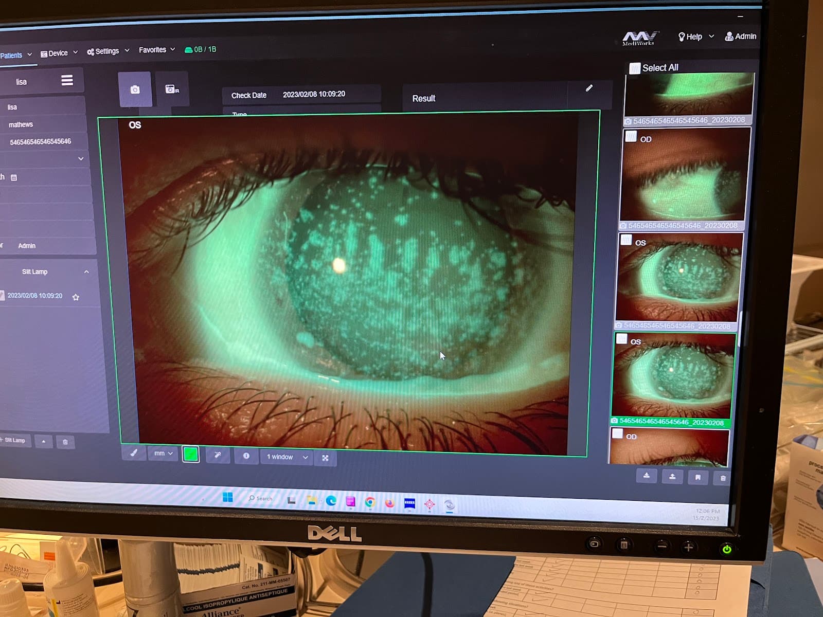 Vancouver Eye Doctor – Dr. Mahnia Madan, OD, FAAO photo 4