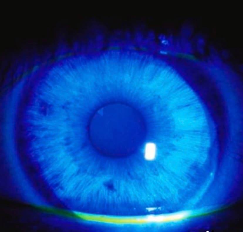 Vancouver Eye Doctor – Dr. Mahnia Madan, OD, FAAO photo 5