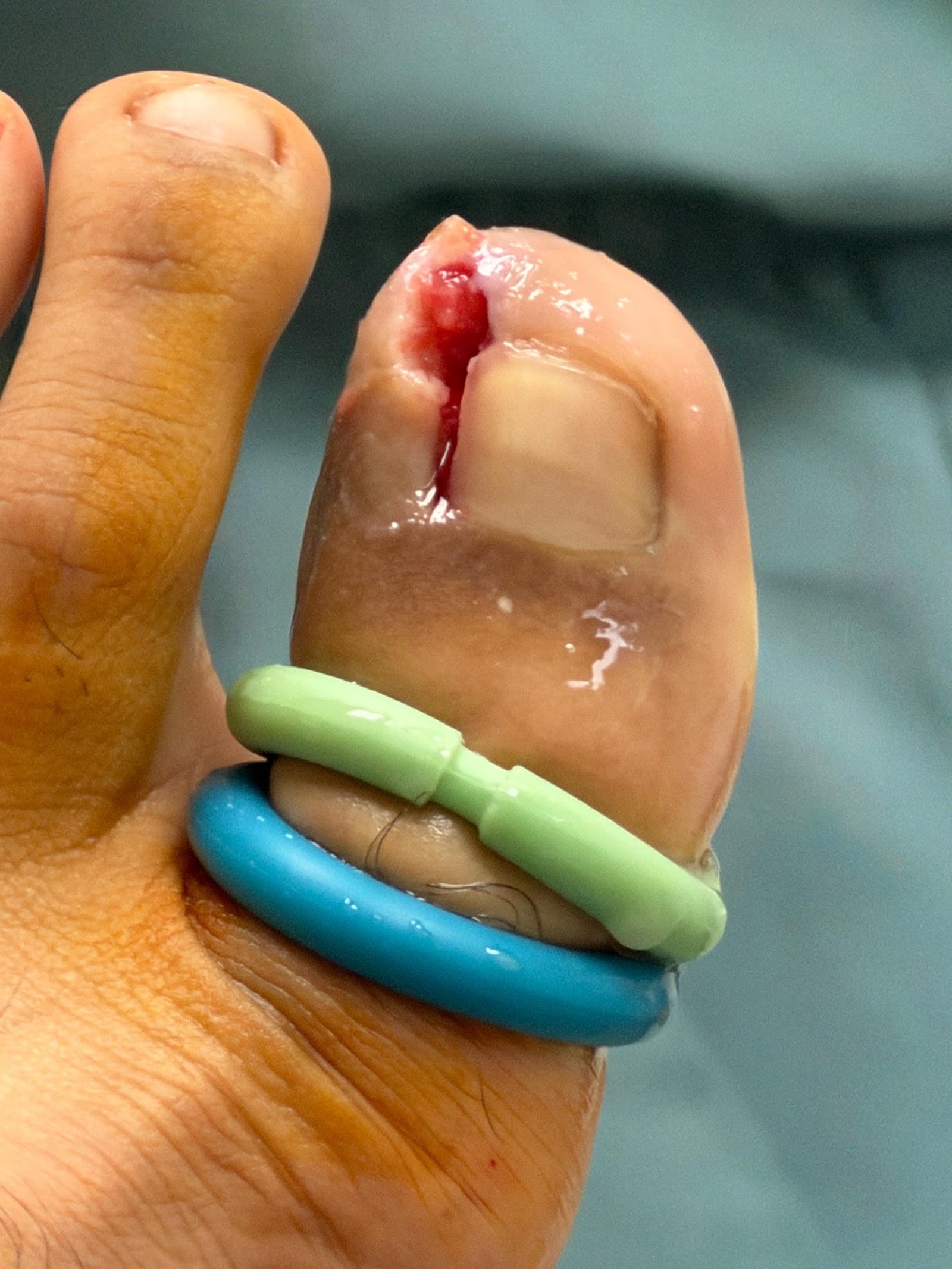 West Toronto Foot & Ankle Clinic, podiatry & foot care in Toronto, photo 3